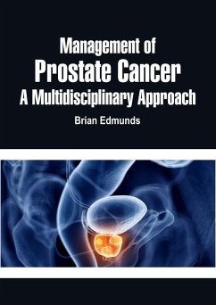 Cover Management of Prostate Cancer (eBook, ePUB)