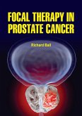 Focal Therapy in Prostate Cancer (eBook, ePUB)