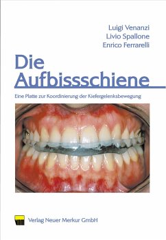 Die Aufbissschiene (eBook, PDF) - Venanzi, Luigi; Spallone, Livio; Ferrarelli, Enrico