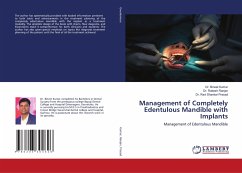 Management of Completely Edentulous Mandible with Implants - Kumar, Dr. Bineet;Ranjan, Dr. Rakesh;Prasad, Dr. Ravi Shankar