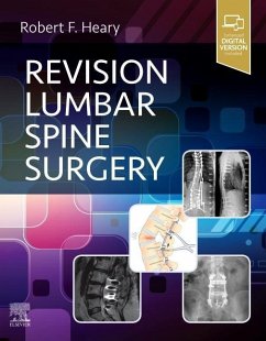 Cover Revision Lumbar Spine Surgery