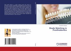 Shade Matching in Prosthodontics