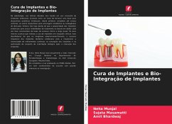 Cura de Implantes e Bio- Integração de Implantes - Munjal, Neha;Masamatti, Sujata;Bhardwaj, Amit