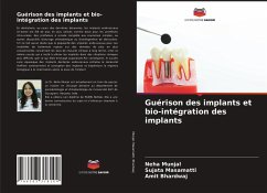 Guérison des implants et bio-intégration des implants - Munjal, Neha;Masamatti, Sujata;Bhardwaj, Amit