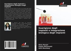 Guarigione degli impianti e integrazione biologica degli impianti - Munjal, Neha;Masamatti, Sujata;Bhardwaj, Amit