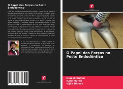 O Papel das Forças no Posto Endodôntico - Kumar, Dinesh;Maran, Karu;Dinesh, Vijila