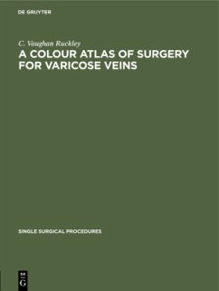 A Colour Atlas of Surgery for Varicose Veins - Ruckley, C. Vaughan