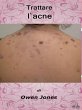 Trattare L'Acne (eBook, ePUB) - Bild 1
