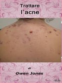 Trattare L'Acne (eBook, ePUB)