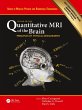 Quantitative MRI of the Brain - Bild 1