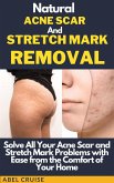 Natural Acne Scar and Stretch Mark Removal (eBook, ePUB)
