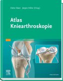 Atlas Kniearthroskopie (eBook, ePUB)