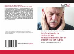 Disfunción de la articulación temporomandibular en pacientes con lupus - Alemán, Otto;Fonseca, Gloria Marina;Arias, Yanier