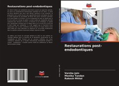 Restaurations post-endodontiques - Jain, Varsha;Tandan, Monika;Mittal, Rakesh