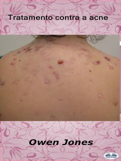 Tratamento Contra A Acne (eBook, ePUB) - Jones, Owen