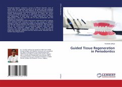 Guided Tissue Regeneration in Periodontics