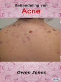 Behandeling Van Acne (eBook, ePUB)