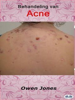 Behandeling Van Acne (eBook, ePUB) - Jones, Owen