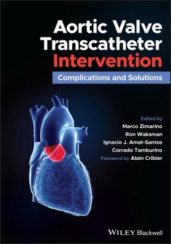 Aortic Valve Transcatheter Intervention (eBook, PDF)