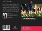 Ónixis dermatofítica