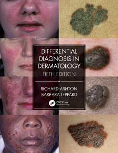 Differential Diagnosis in Dermatology (eBook, ePUB) Cover Differential Diagnosis in Dermatology (eBook, ePUB)