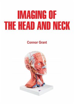 Imaging of the Head and Neck (eBook, ePUB) - Grant, Connor