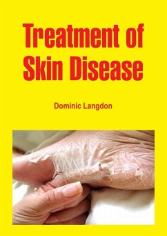 Treatment of Skin Disease (eBook, ePUB) - Langdon, Dominic