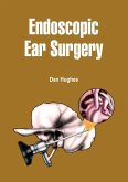 Endoscopic Ear Surgery (eBook, ePUB)