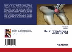 Role of Forces Acting on Endodontic Post
