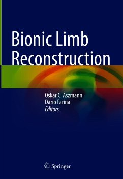 Bionic Limb Reconstruction (eBook, PDF)