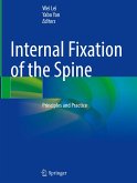 Internal Fixation of the Spine