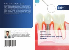 Endosseous Dental Implant Systems - Sethia, Abhijit;Punia, Vikas;Khandelwal, Meenakshi