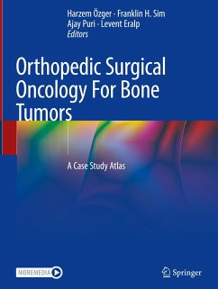 Orthopedic Surgical Oncology For Bone Tumors