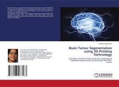 Brain Tumor Segmentation using 3D Printing Technology