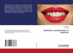 Aesthetic consideration in Implants - Singh, Komal;Saha, M.K