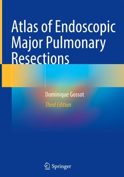 Atlas of Endoscopic Major Pulmonary Resections - Gossot, Dominique