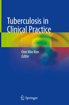 Tuberculosis in Clinical Practice