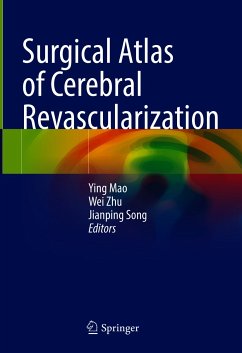 Surgical Atlas of Cerebral Revascularization (eBook, PDF)