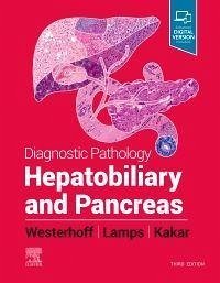 Diagnostic Pathology: Hepatobiliary and Pancreas - Lamps, Laura W; Westerhoff, Maria; Kakar, Sanjay