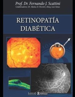 Retinopatía diabética: Oftalmología - Pierotti, Matías; Simes, Luis; Scattini, Fernando