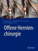 Offene Hernienchirurgie (eBook, PDF)