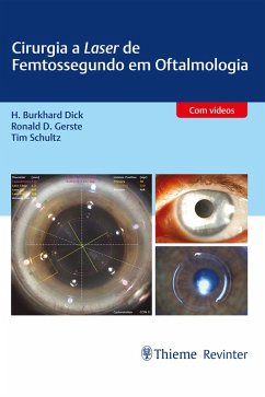 Cirurgia a Laser de Femtossegundo em Oftalmologia (eBook, ePUB) - Dick, H. Burkhard; Gerste, Ronald D.; Schultz, Tim