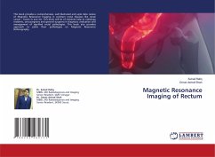 Magnetic Resonance Imaging of Rectum