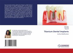 Titanium Dental Implants - RAJU, DELSA;Raja, Jacob;G., Seema