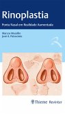 Rinoplastia (eBook, ePUB)