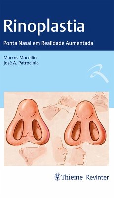 Cover Rinoplastia (eBook, ePUB)