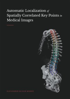 Automatic Localization of Spatially Correlated Key Points in Medical Images