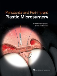 Periodontal and Peri-implant Plastic Microsurgery (eBook, ePUB) - de Campos, Glécio Vaz; Lopes, Cláudio Julio