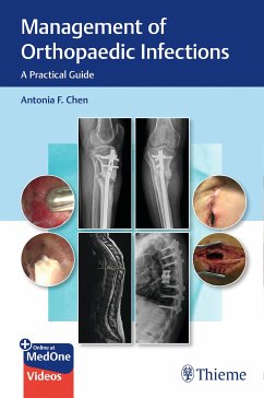 Management of Orthopaedic Infections (eBook, PDF) - Chen, Antonia