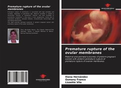 Premature rupture of the ovular membranes - Hernández, Iliana; Franco, Osmany; Vila, Lizzette